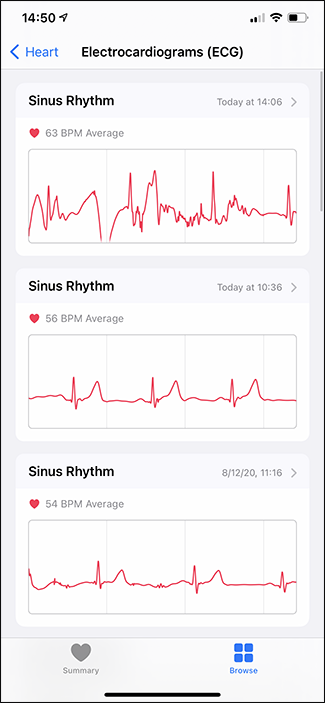 ecgs no aplicativo de saúde