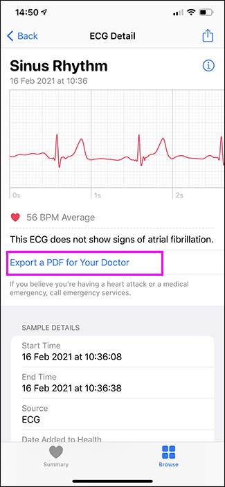 ecg individual no aplicativo de saúde