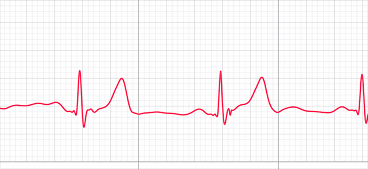 Visualização de ECG mostrando ritmo sinusal