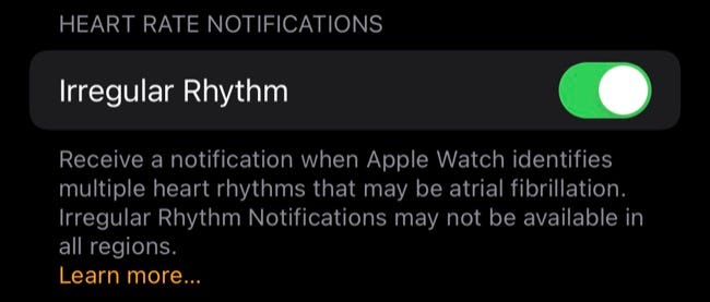 Notificações de ritmo irregular no Apple Watch