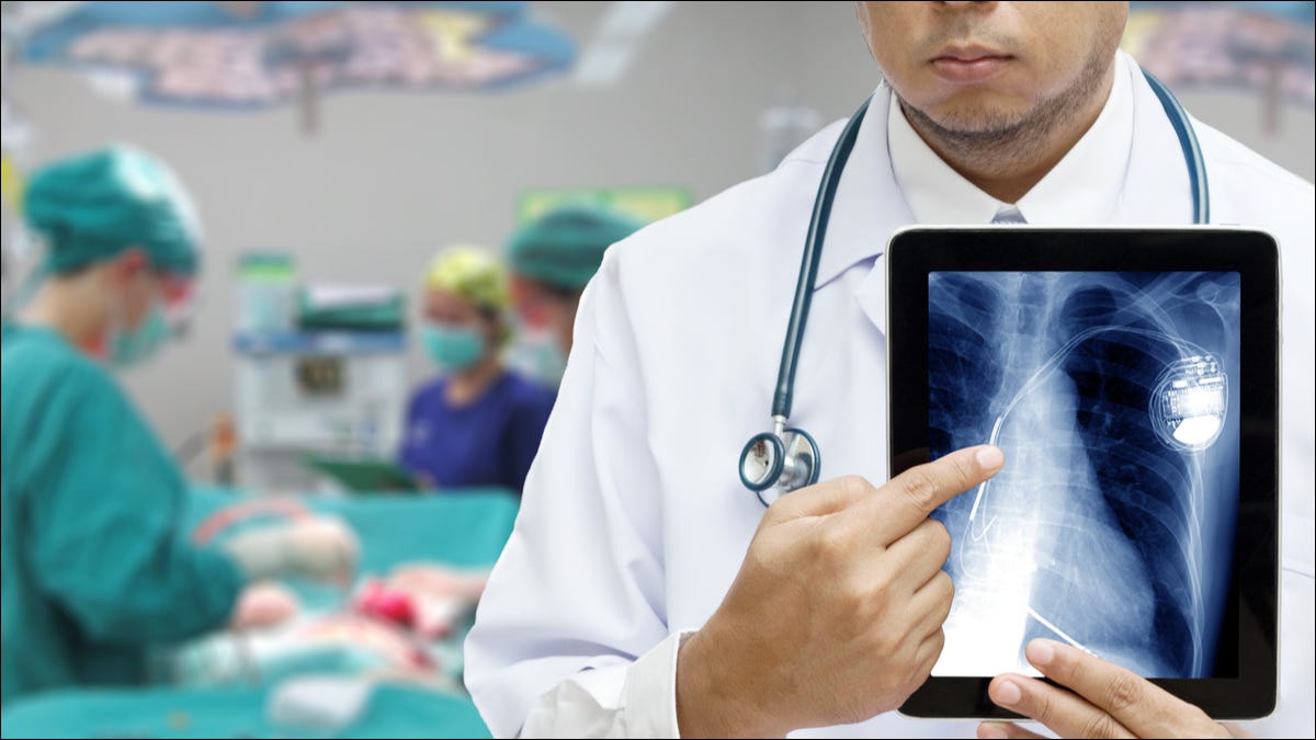 Um médico apontando para um implante de marca-passo em um iPad