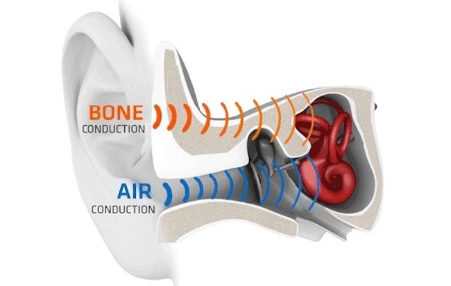 Um diagrama de uma orelha mostrando a condução óssea contornando o canal auditivo.